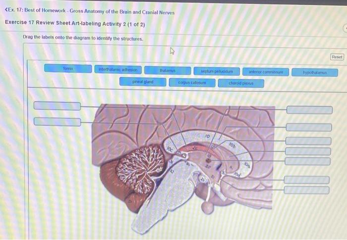 13 exercise sheet review labeling activity solved correct wrong please